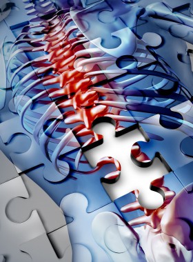 Still Puzzled by Your Back Pain? Still Puzzled by Your Back Pain?