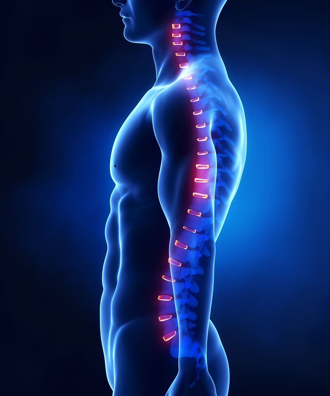 Degenerative disc disease