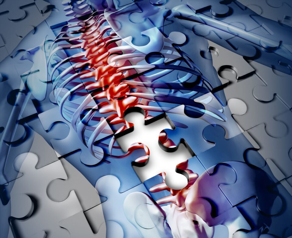 Still puzzled by back pain