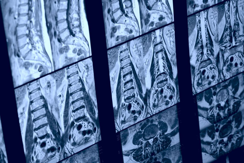 What does your back look like on scan